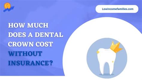 How Much Does The Dentist Cost Without Insurance