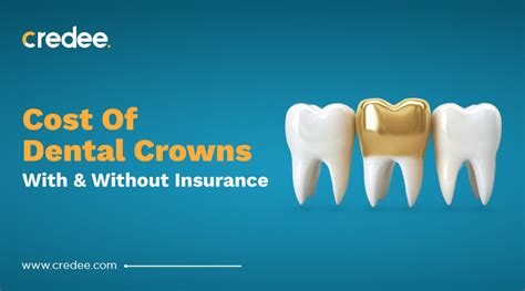 How Much Is A Dental Crowns Without Insurance In 2025 Credee How Much Is A Dental Crowns Without Insurance In 2025 Credee