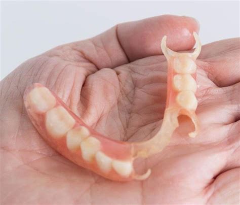 Permanent Partial Denture Hummingbird Dental Voted Top Choice Permanent Partial Denture Hummingbird Dental Voted Top Choice